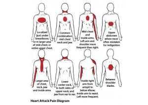 How To Recognize a Heart Attack One Month Before It Happens!