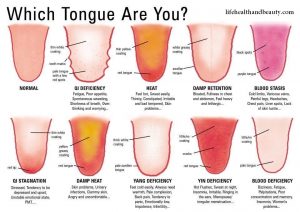 What Does Your Tongue Says About Your Health