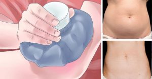 Kill Belly Fat Cells Instantly Using Ice Packs! The Results Are Amazingly Fast!