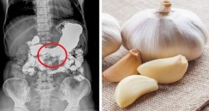 Here’s What Happens When You Eat Garlic On An Empty Stomach For 7 Days